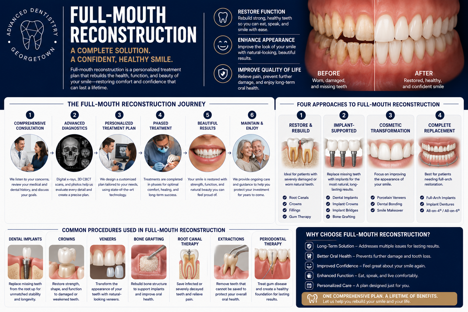 Complete guide to full-mouth reconstruction — journey, approaches, and procedures at Georgetown Advanced Dentistry
