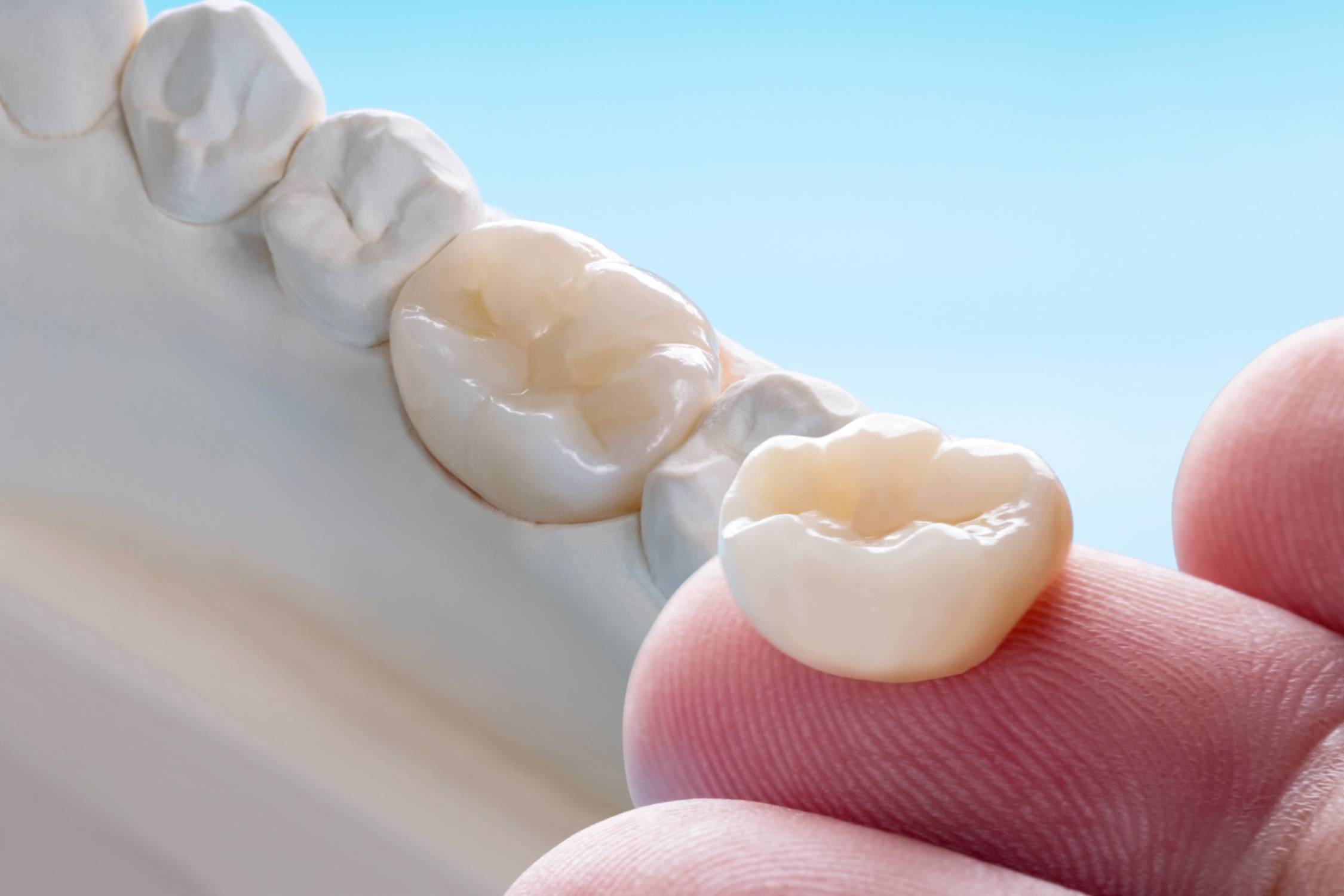 Custom-fabricated dental crown at Georgetown Advanced Dentistry in Washington, DC