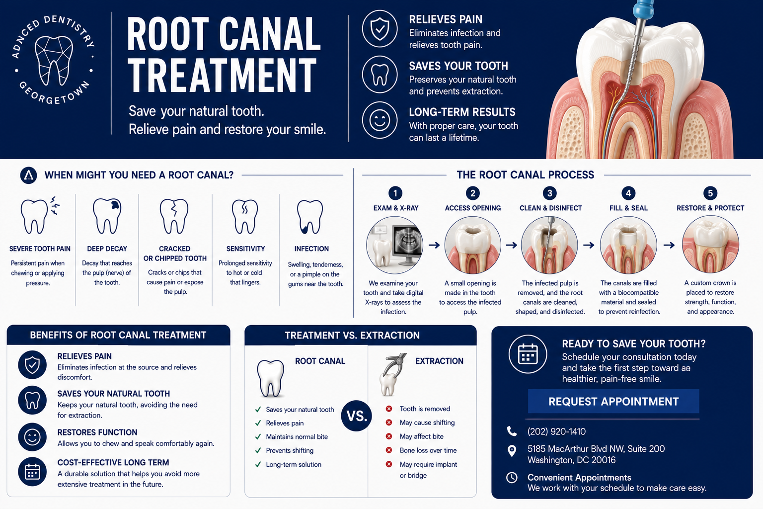 Complete guide to root canal treatment — process, benefits, and treatment vs. extraction comparison at Georgetown Advanced Dentistry