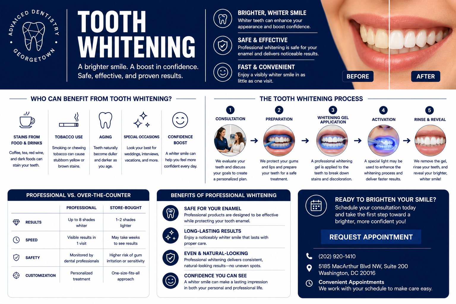 Complete guide to professional teeth whitening — process, benefits, and comparison at Georgetown Advanced Dentistry